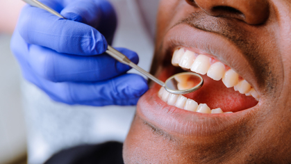 dentist examines mouth